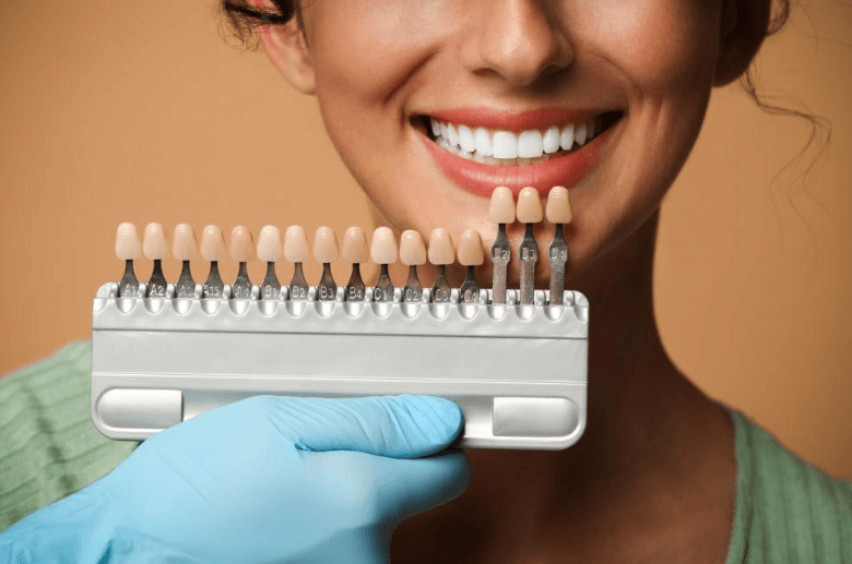 4 Signs It’s Time To Consider Whitening, Bonding, Or Veneers