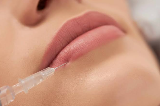 Filler Dissolving With Hyaluronidase: When and Why It’s Used